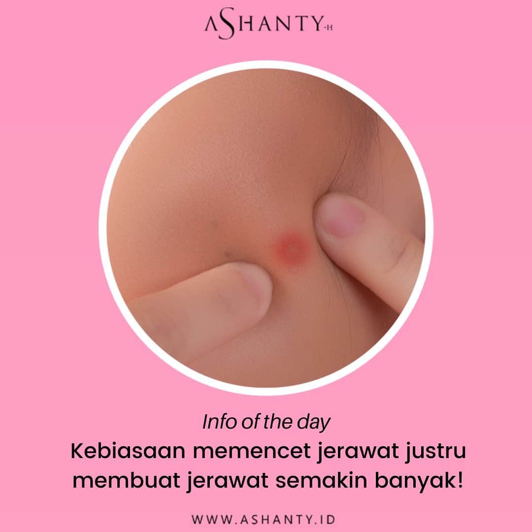 ASHANTY BEAUTY CREAM OFFICIALのインスタグラム：「Ladies, ternyata kebiasaan memencet jerawat bukan malah menghilangkan jerawat tetapi justru membuat jerawat semakin banyak! Mulai dari sekarang stop memencet jerawat yaa ladies. Mau jerawatmu hilang ? Solusinya dengan rutin menggunakan skincare by @ashantyid Acne Cream Series membantu mencerahkan wajah, meghilangkan jerawat yang membandel, menghilangkan noda bekas jerawat, merawat dan menutrisi kulit wajah sampai lapisan terdalam 😘  _____________________________ Informasi dan pemesanan  Ashanty Beauty Cream Chat Via WA : 📱 081293823950 📱 085781140354 📱 087778489900 📱 081287388885 ⚡️ Fast Respons Click Link On Bio Instagram @ashantyid ❣️ ______________________________ #ashantybeautycream #creamashanty #skincareashanty #skincare #skincareartis #skincarelokal #creamwajah #creamperawatanwajah #obatjerawat #jerawat #kosmetik #krimwajah #creamwajah #whiteningcream #ashantyid #ashanty」