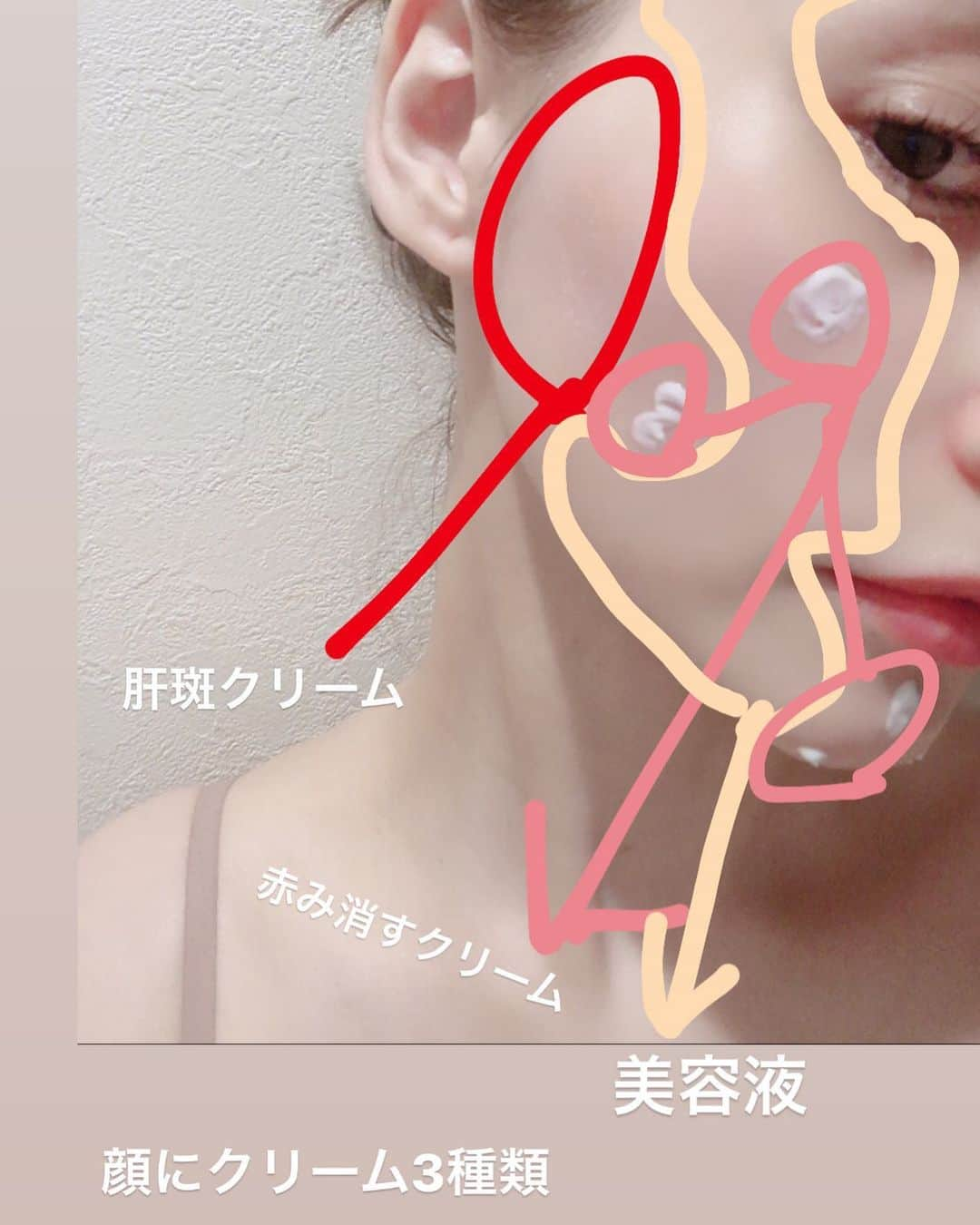 ダレノガレ明美（美容アカウント）さんのインスタグラム写真 - (ダレノガレ明美（美容アカウント）Instagram)「季節の変わり目は顔にクリーム3種類。 肝斑クリームは うすーく肝斑がでてきたのでスタートしました！ 濃くなってから始めたらすごく時間がかかるので… 2〜3ヵ月で消えてくれたら嬉しいな！ 肝斑ってすごく難しくて、レーザーだとなかなか消えにくかったり、レーザー高額だったり、赤みがでたりで本当やっかいなの… 肝斑が出ないようにしっかり日焼け止めはみんな塗るようにね！ 私は4年前のハワイで日焼け止め塗らずに過ごして出てきちゃったから後悔… 赤みを消すクリームは オープンするエステで購入できるクリームなんですが、赤みなど万能クリームです。 ニキビにも使ってるし、本当肌の🆘の時はこれを塗ります！オープンしたら皆さん１本は購入するのおススメします！ また詳しく載せます！ 美容液はクレーム ドゥ･ラ･メールです。 もちろんこのクリーム前には化粧水など塗って最後に部分で3種類のクリームを塗ってます✨」6月17日 1時22分 - akem.ibeauty