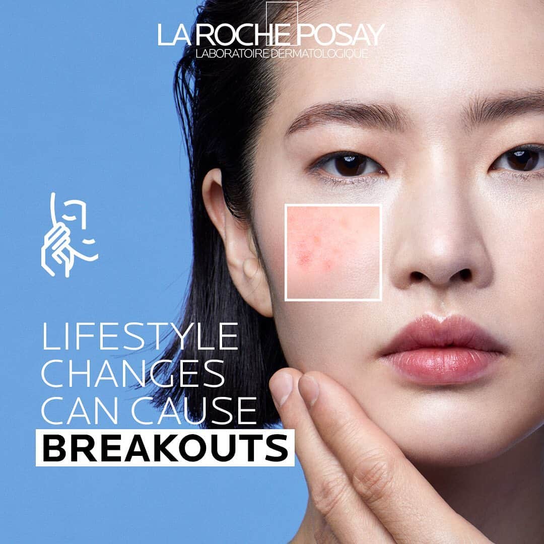 La Roche-Posayさんのインスタグラム写真 - (La Roche-PosayInstagram)「Bad food habits, pollution, stress, lack of exercise… Oily skin and pimples have plenty of reasons to appear. To avoid breakouts, try out this acne-prone skin Effaclar routine, helping to reduce marks and imperfections. All languages spoken here! Feel free to talk to us at any time. #larocheposay #effaclar #acneproneskin Global official page from La Roche-Posay, France」6月17日 2時18分 - larocheposay
