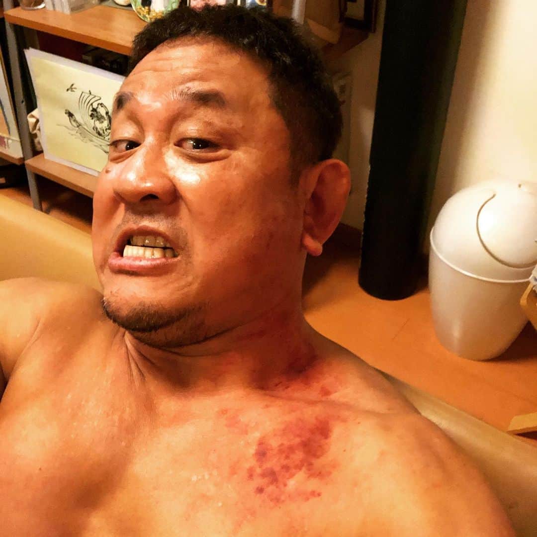 永田裕志さんのインスタグラム写真 - (永田裕志Instagram)「今宵NJC公式戦初戦は激闘の末、勝利することが出来ました。 沢山の応援ありがとうございました😊。 しかし、勝利の代償は痛かったな(笑)。 次はアイツ。 私の底力を全世界に披露致しましょう。 #永田裕志  #njpw  #NJC」6月17日 22時05分 - yuji_nagata