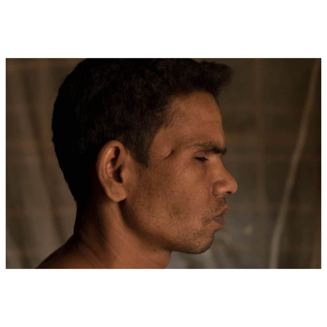 Magnum Photosさんのインスタグラム写真 - (Magnum PhotosInstagram)「"29-year-old Mohammad Sultan told me, through my translator, that soon after his younger brother was shot dead, he was shot at point blank at their rice field near Maungdaw in the Rahkine State of Myanmar in early October, 2016. The bullet entered his left temple and the bullet exited his right temple. Miraculously, he has survived but gone blind completely. He with his wife, their four children and relatives managed to escape to Bangladesh in late October, 2016. There is no hope or guarantee of safe return in sight. Life has been all only reserved to waiting in the makeshift refugee camp in Cox’s Bazar. Cox's Bazar. Bangladesh. October 30, 2017."⁠ .⁠ Today is World Refugee Day. @chien_chi_chang's images from his visit to Cox’s Bazar in 2017 documented life in the Rohingya refugee camps in Bangladesh.⁠ .⁠ © @chien_chi_chang/#MagnumPhotos⁠ .⁠ #WorldRefugeeDay」6月21日 6時00分 - magnumphotos