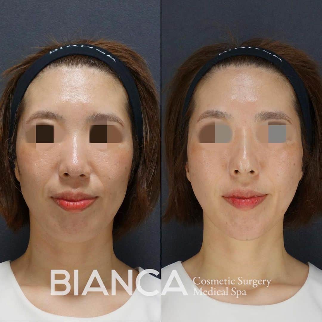 辻沢由有（BIANCA CLNIC 表参道院 院長）のインスタグラム
