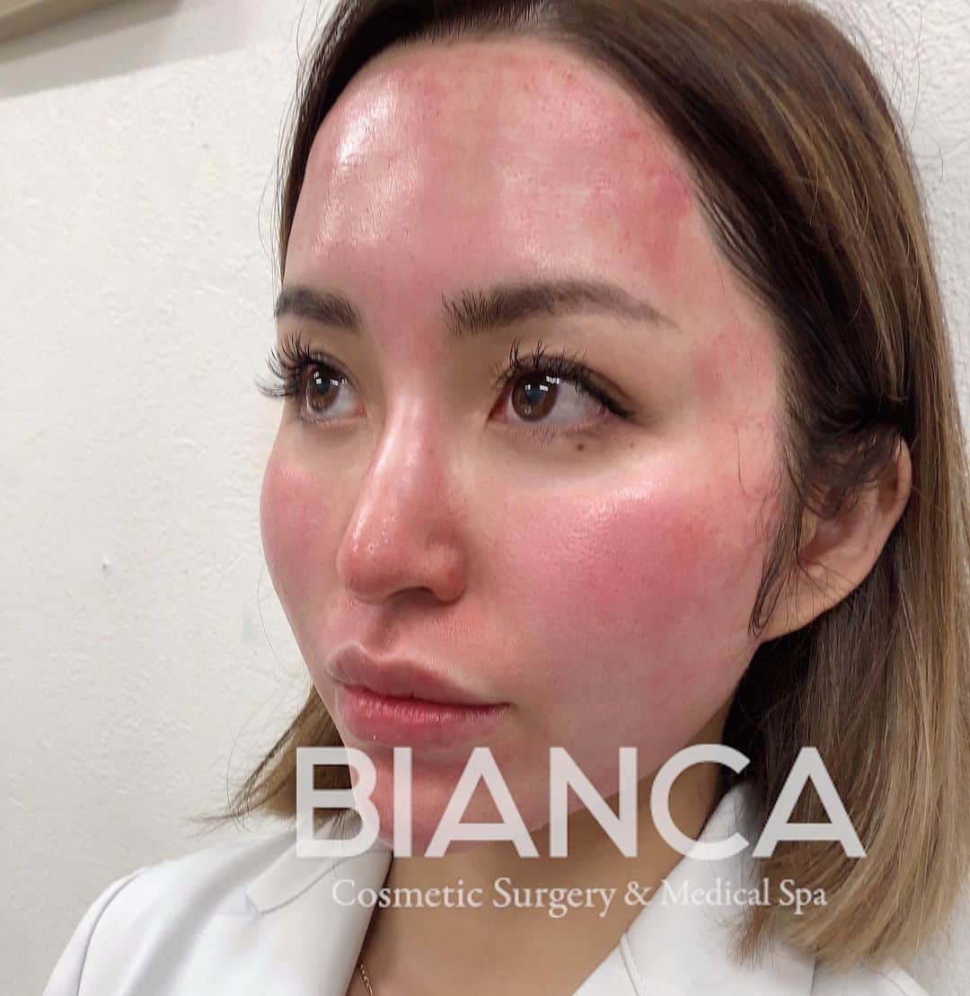 辻沢由有（BIANCA CLNIC 表参道院 院長）のインスタグラム