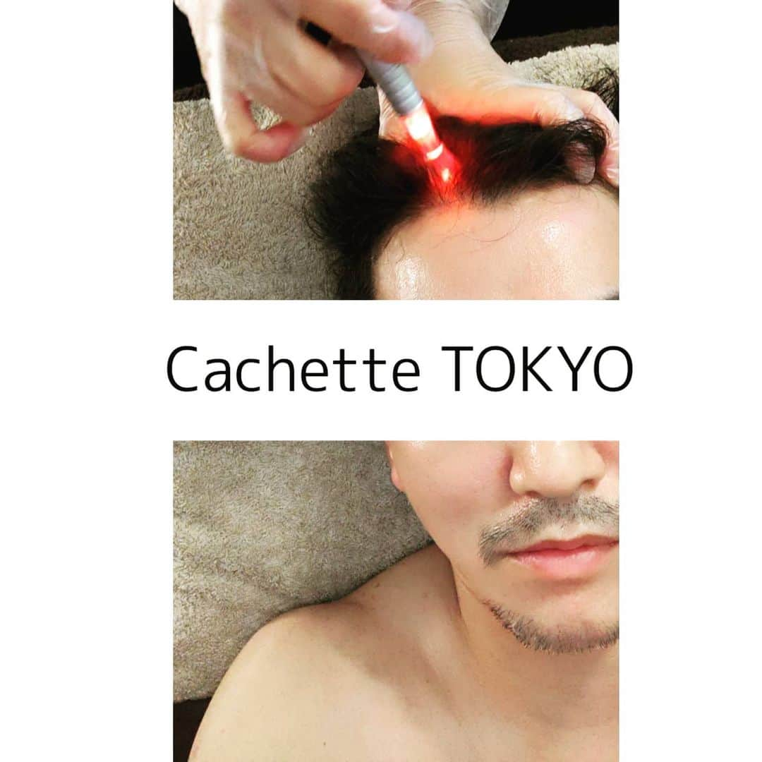 福川雅顕さんのインスタグラム写真 - (福川雅顕Instagram)「. @cachette_tokyo . 顔、首、頭皮にハイパージェット 角質層にニードルで刺激を与えて塗布した美容成分の浸透促進させてくれる 頭皮用に @tokyo_bihatsu_lab の 育毛剤を持参で来ましたw . マジックポットは脂肪溶解、リンパドレナージュ、筋肉の疲労回復に効果的 #膝上のたるみとシワ撃退 . 僕の筋肉はやっぱりガチガチみたいです… だからヘルニアになったり、関節を痛めたりしやすいみたい 体のケアはちゃんとしないとなぁ #シャンとしたジジイになりたい . #ハイパージェット #hyperjet #マジックポット #magicpot  #エステ #bodycare  #ハゲ対策 #美容おたく  #美容 #美容おじさん #美容好きな人と繋がりたい」6月24日 16時26分 - masaakifukugawa