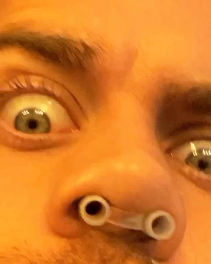 モデル、ブロック・オハーンのインスタグラム：「Had surgery on my deviated septum. (Ive had it for over 15 years) I’ve got 6 inch tubes and stitches, among other things shoved up my nose.   And the craziest part to me is that I had to shave for surgery and this is the first time I’ve seen my face in almost a decade lol 👶🏽」