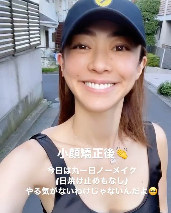 のインスタグラム：「コロナでずっと行けなかった@kogao_seisakusho でメンテナンスにやっと行けた🥰🥰🥰 なんて気持ちいいの🥺💕 右と左の顔が違うからほんと嫌で、バランス良く整えてもらいました☺️ 鼻高高してくれてスッキリ🌟 香港でも受けれるよ🙌🙌🙌 @ipsvipclub  ・ #すっぴんべいびー  #小顔 #小顔矯正 #小顔になりたい #小顔製作所  #美容好きな人と繋がりたい」