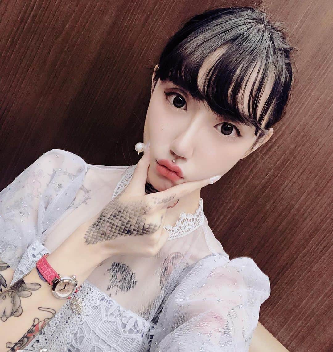 水森翠のインスタグラム：「ぷくぷくほっぺがほっそりしますように♡ #食いしばり #治療」
