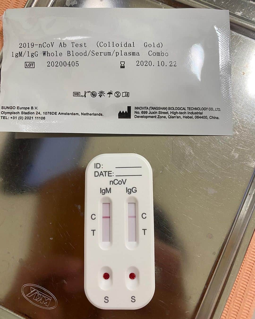 狩野恵輔さんのインスタグラム写真 - (狩野恵輔Instagram)「抗体検査してきました。 素早く、低価格で検査してくれました。 歯科なので歯も検査してもらいました。  #かなえデンタルクリニック #ホワイトニング #アートメイク #抗体検査 #狩野恵輔」7月22日 11時23分 - keisuke_kanoh_official