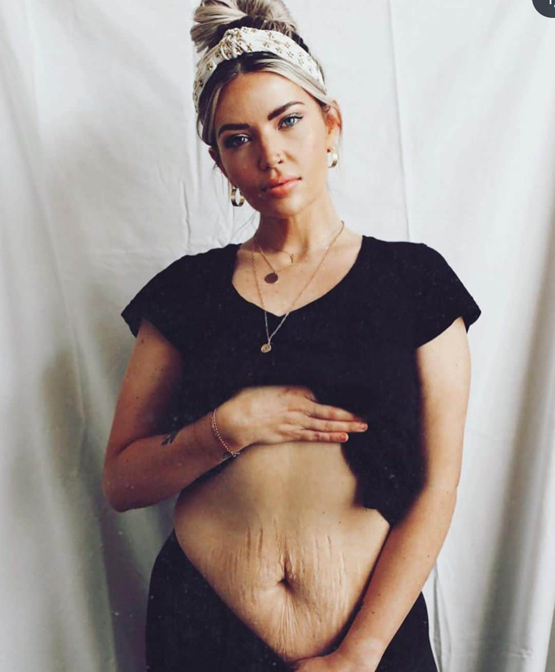 タミン・サーソクさんのインスタグラム写真 - (タミン・サーソクInstagram)「Today on our podcast @womenontopofficial we speak about one of the most important subjects which is body shame and confidence surrounding our bodies. This conversation with @thebirdspapaya was raw, poignant and important. She has a similar story to mine and is on a mission to change the stigma surrounding body size. Please please listen to this episode. It’s such a necessary conversation to be had. ❤️」7月23日 2時16分 - tamminsursok