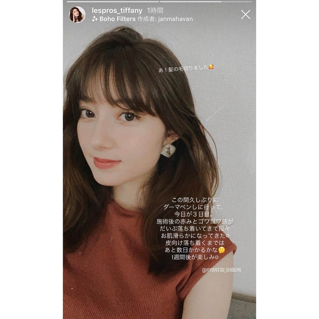 のインスタグラム：「ありがとうございました💖 @lespros_tiffany ・ #共立美容外科 #芸能人御用達 #ティファニー春香 #ダーマペン #ダーマペン4 #ヴァンパイアフェイシャル #肌質改善 #ニキビ跡ケア #ニキビ跡改善 #毛穴の開き #毛穴の開き改善 #美肌」
