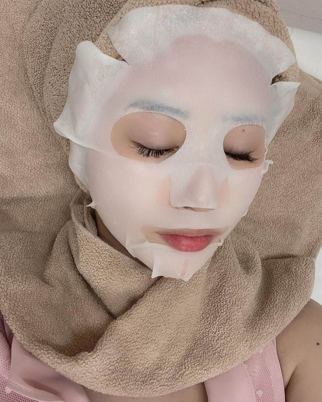 SHIHOさんのインスタグラム写真 - (SHIHOInstagram)「. . @emiri_aizawa さんのクリニック💉❤️ . @venus_beauty_clinic に行ってきました🥰 . . #ダーマペン4 をしてきました✌️ 成長因子、パックもしていただきました💕 . . アンチエイジングや再生治療に効果的(*´───`*)✨ . ニキビ跡やニキビを改善して美肌になるために💓 麻酔クリームをするから痛みはなかったです😍 . . 2、3日は赤みが出るみたいなんですが お肌が綺麗になるの楽しみ🥳💋 . . この日のお洋服は @micoameriofficial 😍 . 大きめのフリルで腕が細く見える🤍 フワッと広がるワンピース👗♡ . . #venusbeautyclinic #beauty #beautyclinic #肌管理 #成長因子 #アンチエイジング #再生医療 #ニキビケア #ヴィーナスビューティークリニック #クリニック #整形 #ミコアメリ #micoameri」6月29日 15時41分 - cham_pipi