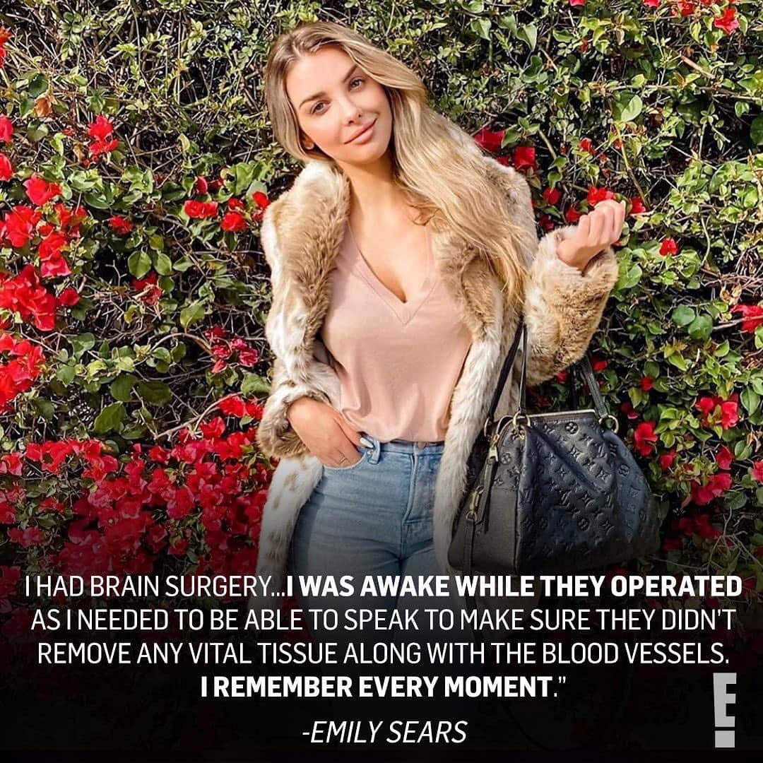 E! Onlineさんのインスタグラム写真 - (E! OnlineInstagram)「Model Emily Sears revealed she had brain surgery last week—and was awake for the whole thing. 😳 Her surreal story is at the link in our bio. (📷: @emilysears)」7月1日 1時17分 - enews