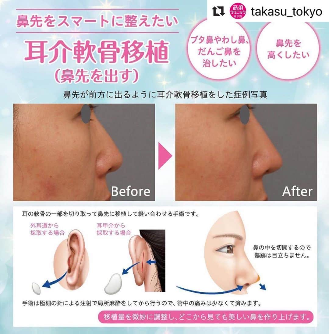 高須クリニックのインスタグラム