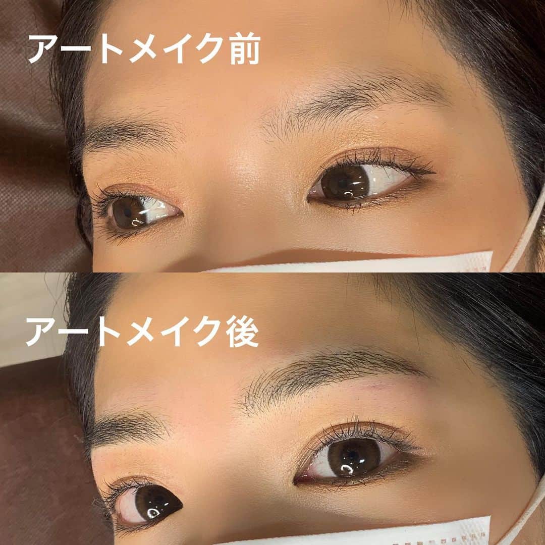 mocchiのインスタグラム：「2020.07.01 今日はずっと気になってて行きたかった @medicalbrows_nagoya さんへ行ってきたよー！！ ・ ・ 担当は @medicalbrows_kanayama さんにお願いしました✨ ・ ・ あたしはアートメイクは人生初！ 痛いのかとめちゃくちゃドキドキしてたんだけどw ・ 麻酔クリームを塗ってからやってもらうんだけど、全然痛くなくて開始5分くらいで爆睡してた🤣 ・ ・ ・ 6Dストロークっていう技術で1本ずつ眉毛を書いてくれて、立体的で自眉毛みたいになるの凄くない？？😳 ・ 感動😳✨ ・ ・ 眉毛って左右対象に上手く書けなかったりして メイクの中でも結構眉毛に時間かかってたから、これから楽になる✨ ・ ・ @medicalbrows さんは2回セットだから、また2ヶ月後くらいにもぉ1度入れて完成らしい✨ ・ ・ すっぴんでも眉毛があるだけで印象全然違うから 本当にやって良かったー！！ ・ ・ 完成が楽しみ☺️ ・ ・ ・  #Medicalbrows #メディカルブロー #メッディカルブロー名古屋院 #アートメイク大名古屋 #アートメイク #メディカルアートメイク #6Dストローク #アートメイク眉」