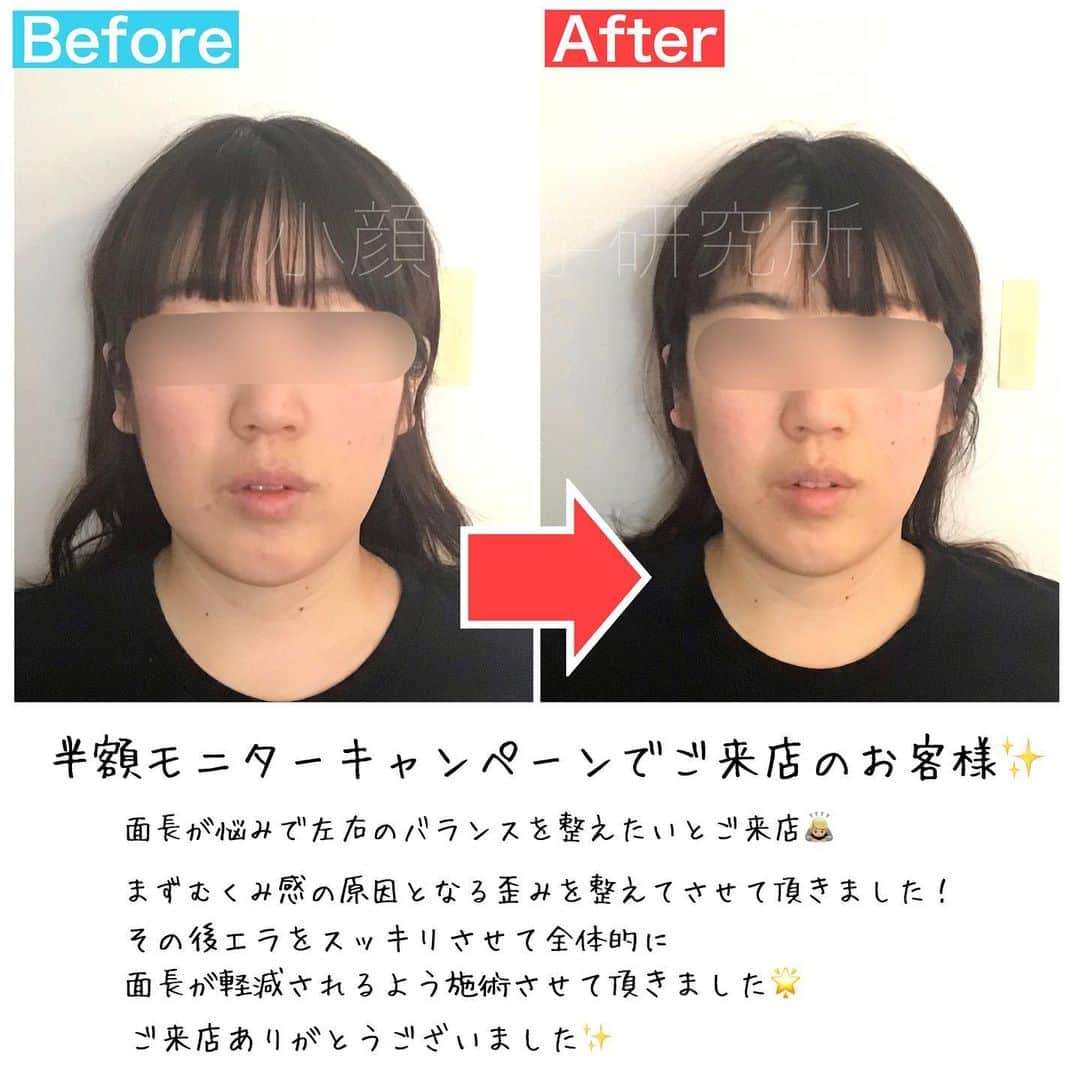 小顔科学研究所 のインスタグラム