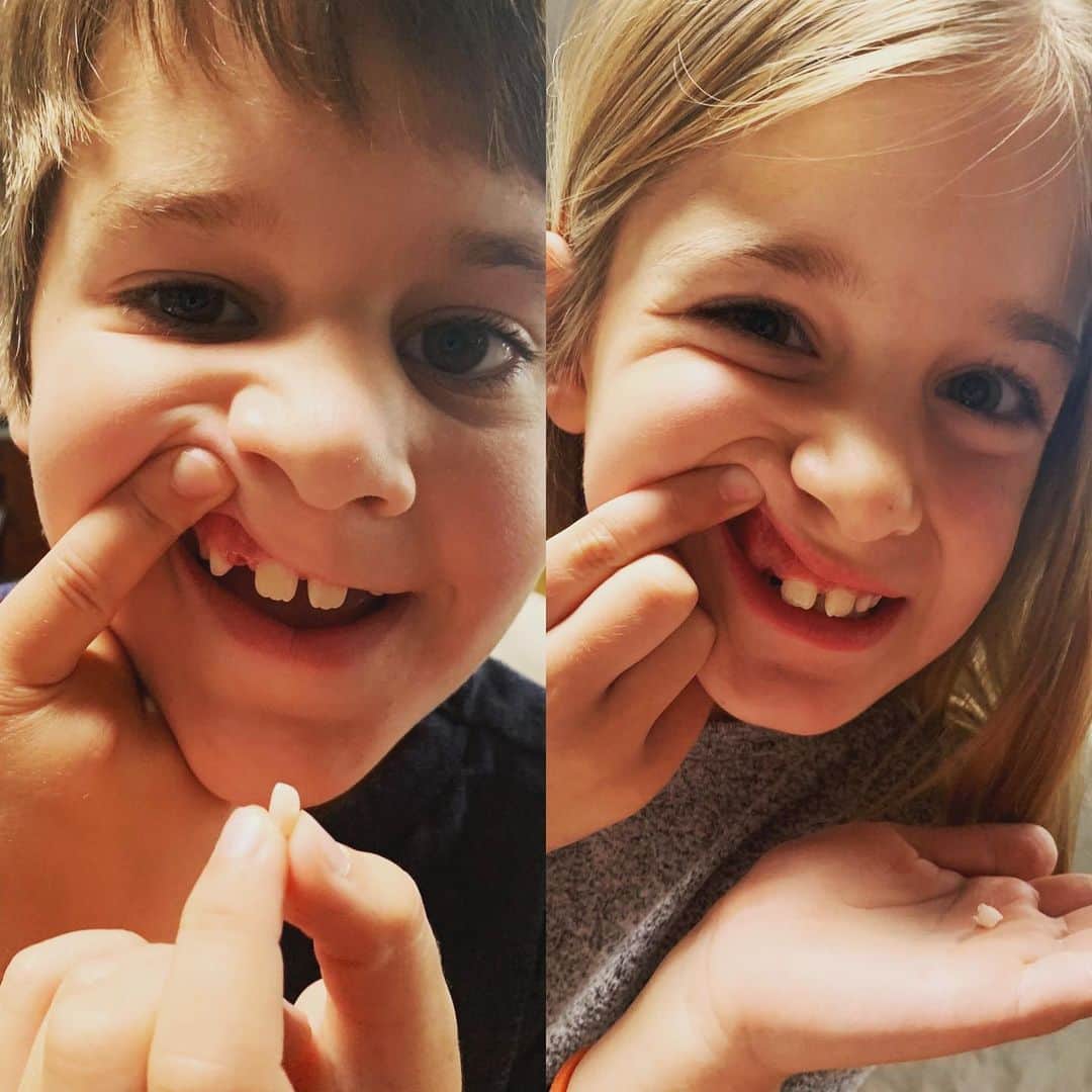 タック・ワトキンスさんのインスタグラム写真 - (タック・ワトキンスInstagram)「7 1/2 years ago Harris Ransom-Howe was born 22 minutes after his twin sister. Today he lost a tooth 22 minutes after she lost the same tooth. #Whaaaaat?! #NostradamusPredictedThis #SignsOfTheApocalypse」7月2日 3時57分 - tucwatkins