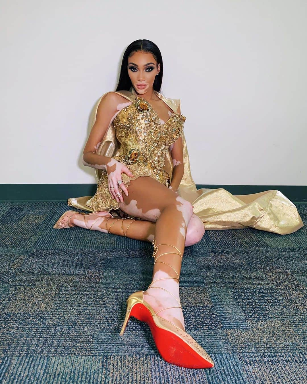 ウィニー・ハーロウさんのインスタグラム写真 - (ウィニー・ハーロウInstagram)「Goldie ✨」7月3日 3時49分 - winnieharlow