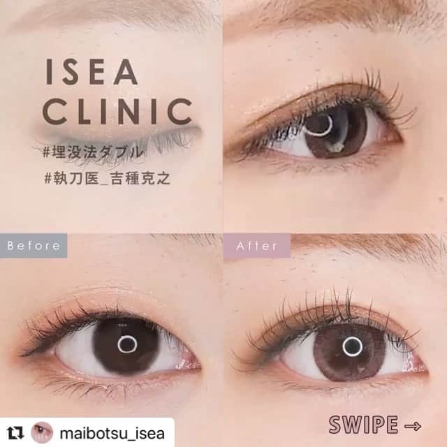 東京イセアクリニックのインスタグラム
