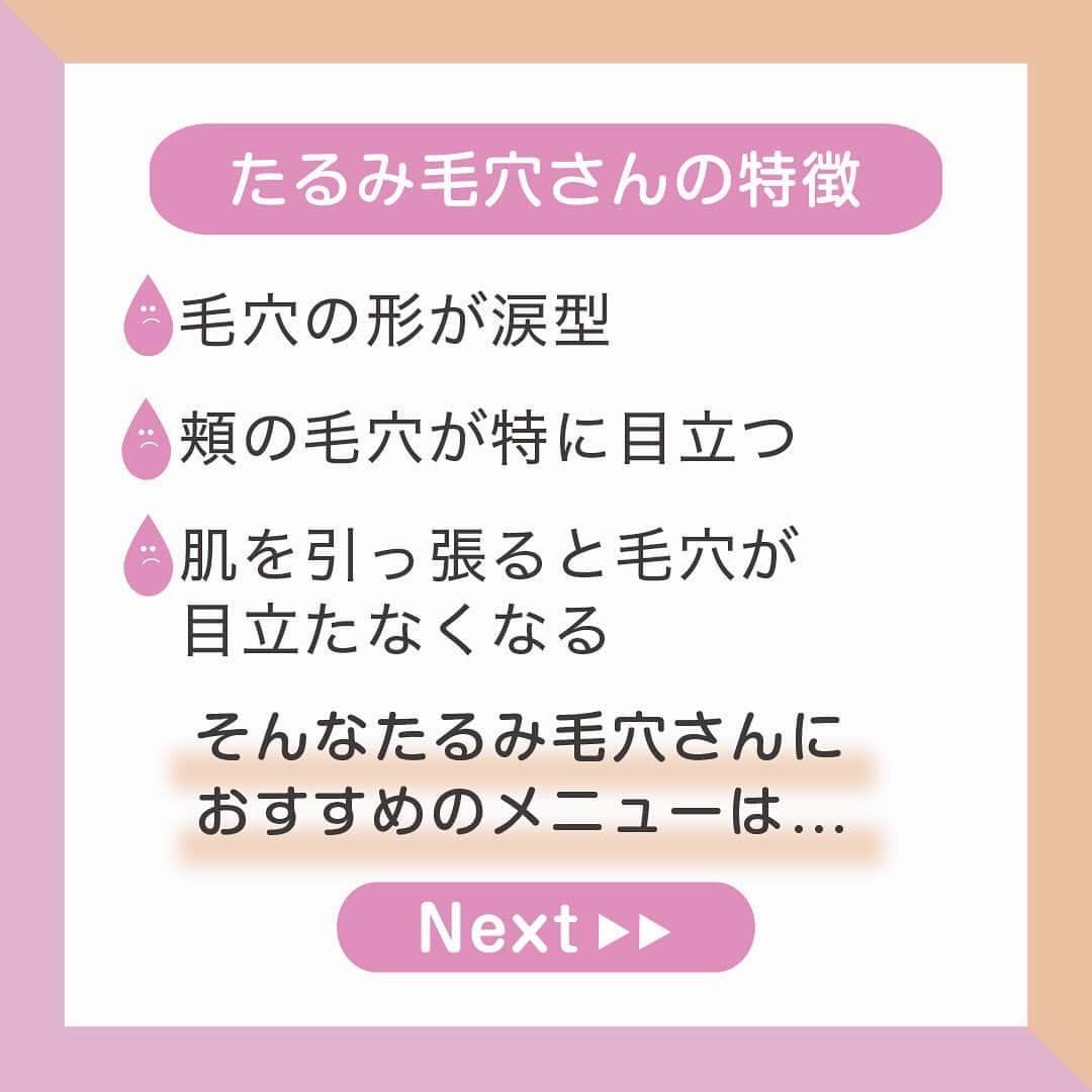 品川美容外科【公式】さんのインスタグラム写真 - (品川美容外科【公式】Instagram)「前回ご好評いただきました、毛穴ケア特集🤗🌟👏🏻✨ . . . 今回は第２弾✌️❣️ 「たるみ毛穴」のケア方法についてご紹介いたします🤫💖✨ . . . 😈たるみ毛穴の特徴😈 . . . ☑️毛穴の形が涙型 . ☑️頬の毛穴が特に目立つ . ☑️肌を引っ張ると毛穴がなくなる . . . 毛穴のたるみは、加齢によりお肌のコラーゲンが減少し、ハリや弾力が失われることでお肌が毛穴を支えきれなくなり、毛穴周辺がゆるむことで起こります😨💦 . . お肌を少し引っ張って毛穴が目立たなくなる場合は、たるみが原因かもしれません🙌 . . そんな毛穴のたるみにおすすめのメニューは… 「ダーマペン４」🥰👏🏻💖✨ . . . ダーマペン４は、髪の毛よりも細い超極細針で肌に微細な穴を形成し、コラーゲンやエラスチンの生成を促進します💫 . . これによりお肌のハリや弾力が高まり、なめらかな肌へと導きます😍✌️🌟 . また、有効成分の導入により、お肌のひきしめやリフトアップ効果も期待できます✨ . . . お肌に適した治療方法は、無料カウンセリングでお気軽にご相談ください🤗🌟 . (Tｅl:0120-713-900） . . #品川美容外科 #品川スキンクリニック #ダーマペン #毛穴 #肌トラブル #美容皮膚科 #毛穴治療 #美容好きな人と繋がりたい  #アンチエイジング  #美容医療  #美容医療をもっと身近に  #たるみ改善  #たるみ毛穴  #たるみケア #美肌 #美容 #スキンケア」7月3日 17時25分 - shinagawa.biyou