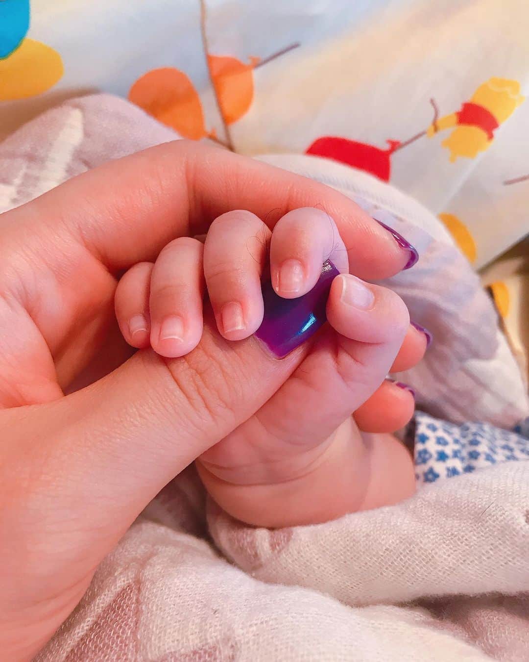 のインスタグラム：「今日で生まれて2ヶ月👶🏽🌈  おそくなりましたが やっと落ちついたのでご報告！  5月4日破水からの緊急帝王切開で出産。 生まれてからすぐ赤ちゃんに 異常がみつかり大きい病院に緊急搬送🏥  出生直後、搬送されたから抱っこはおろか 触れることすら一切できなかった😢  その後、生後2週目にして大きな手術を経験。 無事に手術は成功して快方に向かい 生後40日目に無事に我が家に 帰ってきました👶🏽🌈  サクッと書いてるけど本当に壮絶な 40日間だった！手術が決まるまでは 沢山の管に繋がれてNICUにいた 我が子にちゃんと明日がきてくれるかの 保証もなく、ただただ不安だった😢  けど日々、神秘的な奇跡がおきていって やっと退院出来た時は本当にこの子の 強さと強運さに驚いた✨  妊娠もそうだけど 出産も産後も無事に迎えるのって 本当に奇跡のようなもの。 生きてるって本当にありがたいことだと実感したし この出産で私の死生観がガラッと変わった！  今は夜泣きにてんてこまいだけど そんな当たり前の日常が日々奇跡に思うし幸せ💓  ちなみに妊娠線は全く出来なかった代わりに お腹には切開の勲章🎖が残りました。笑  それすら愛おしい！！  以上、簡単にだけど出産の報告でした👶🏽💜  これからちょっとずつ更新できたら良いなぁ！」