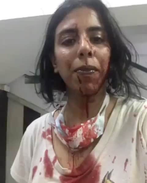 ティモシー・サイクスのインスタグラム：「⚠️WARNING: GRAPHIC IMAGES⚠️ Repost @karmagawa This is animal rescuer Ayesha Christina with three more rescuers who were beaten while they were rescuing dogs in Delhi, India! We must all share her story with our followers and tag people who need to see this because we cannot allow violence like this to happen anymore as too many innocent animals need to be saved from being abused/killed so we need every last rescuer possible — please share this tragic video with your followers and tag people, celebrities, influencers and news media who need to see it and encourage them to share it too, let’s all use our social media platforms to make this go viral and make sure these amazing people will not have to fear for their lives while rescuing animals EVER AGAIN! Let’s ensure a FULL investigation is done to find those responsible and put them in jail so these kind-hearted people can get back to work helping rescue more animals in need without fear of being beaten up! #stoptheviolence #savethedogs #spreadawareness #saveanimals #karmagawa」