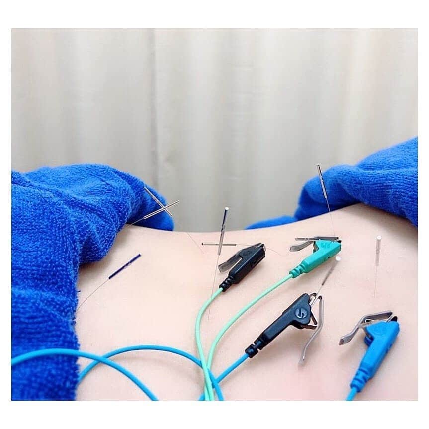 垰智子さんのインスタグラム写真 - (垰智子Instagram)「最近、腰痛がひどくて😂（←おばあちゃん💦） 築地にある@tsukiji_fcc へ行ってきたよ♪ . 背中から腰にかけてかなりハリが 酷かったようで、鍼をうってもらったんだけど、 かなり痛みが無くなって腰が楽チンに✨☺ . 今回は、ショートタイムだったので、 今度はゆっくりやりたいな♡ . . #FCC築地整骨院 #築地マッサージ #整体 #骨盤矯正 #鍼治療 #ヘッドマッサージ #頭痛 #築地整体院 #pr #コラボベース」7月5日 15時36分 - taotao_tomo