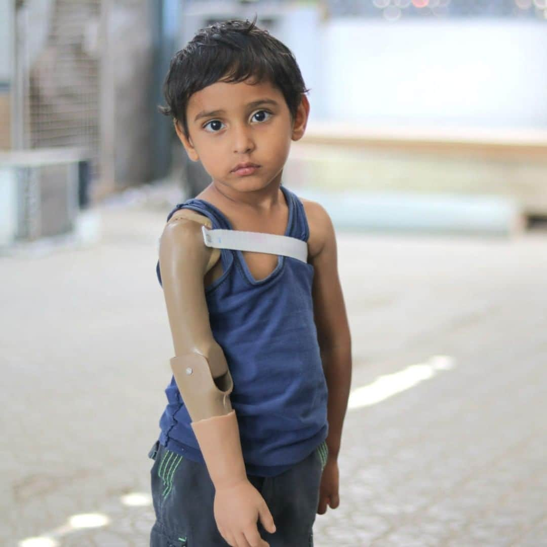 unicefさんのインスタグラム写真 - (unicefInstagram)「Three-year-old Rayan lost his arm when conflict escalated in his hometown of Aden, #Yemen. “A shell came in and cut his arm,” his mother Amina says. “He was in the kitchen getting a glass of water.” ⠀ No child should have to face the consequences of a war they did not create. ⠀  Through @unicef_yemen’s assistance programme, Rayan was fitted for a prosthesis and got access to all the physical therapy and emotional support he needs to learn how to use it. ⠀ #ChildrenUnderAttack⠀  © UNICEF/UNI338366/Alzekri」7月6日 13時05分 - unicef