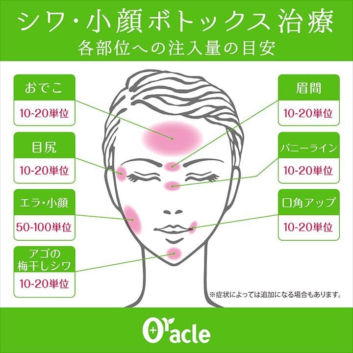 オラクル美容皮膚科東京新宿院さんのインスタグラム写真 - (オラクル美容皮膚科東京新宿院Instagram)「マスクでお肌は隠せても、シワは隠せない…😂﻿ ・﻿ 特に目立つ、額と眉間。﻿ そんなときは、ボトックスであっという間に解決💡﻿ ・﻿ ・﻿ 施術はたったの5分程度。﻿ 約半年に1度の治療でOK🙆‍♀️﻿ 完成まで約5日ほどで効いてきます🎵﻿ ・﻿ ・﻿ スタッフも定期的にボトックス治療して、﻿ アンチエイジングケアをしております。﻿ ・﻿ ・﻿ 1度刻まれてしまうとなかなか取り戻すのが﻿ 難しい表情シワ。﻿ ・﻿ 手軽にできるアンチエイジングとして﻿ 当院でも人気のお手入れとなっております✨﻿ ・﻿ リジェノックス（韓国産）　5000円（税抜）〜﻿ アラガン（アメリカ産）　7000円（税抜）﻿ 〜﻿ ・﻿ ぜひ1度シワとはおさらばして快適に過ごしてみませんか？😊﻿ ・﻿ ﻿  ////////////////////////////////﻿ 【オラクル美容皮膚科】﻿ 詳しくはプロフィールのURLから♪﻿ フリーダイヤル﻿ ☎0120-905-696﻿ コールセンター﻿ 受付時間 9:00～21:00［年中無休］﻿ LINEからもご予約可能です﻿ ID：@oracle.jp﻿ ////////////////////////////////﻿ .﻿ #美容皮膚科 #美容 #美容女子 ﻿ #美容day #美活 #美肌 ﻿ #オラクル美容皮膚科 #オラクル ﻿ #韓国美容 #韓国#美容皮膚科#新宿﻿ #シミ #たるみ #ニキビ #痩身 ﻿  #ピーリング #レーザー #beauty﻿  #プレ花嫁 #ゼオスキン #肌活﻿  #おこもり美容 #ドクターズコスメ #コスメ #乾燥 #保湿 #美容好きな人と繋がりたい  #ボトックス #ボトックス注射 #シワ」7月6日 14時30分 - oraclejp