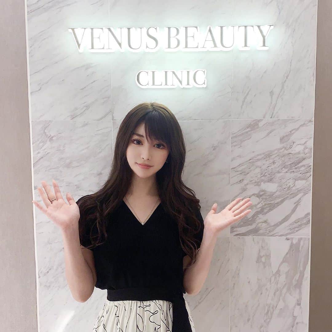 のインスタグラム：「@venus_beauty_clinic 銀座院でW-ハイフしてきました♡  ソノクイーンとダブロゴールドの組み合わせです🥰 直後でもだいぶ変化あったけど本当に変わるのは二ヶ月後くらいだそうなので楽しみ🥺❣️  #clinic #ソノクイーン #ダブロゴールド #ハイフ」