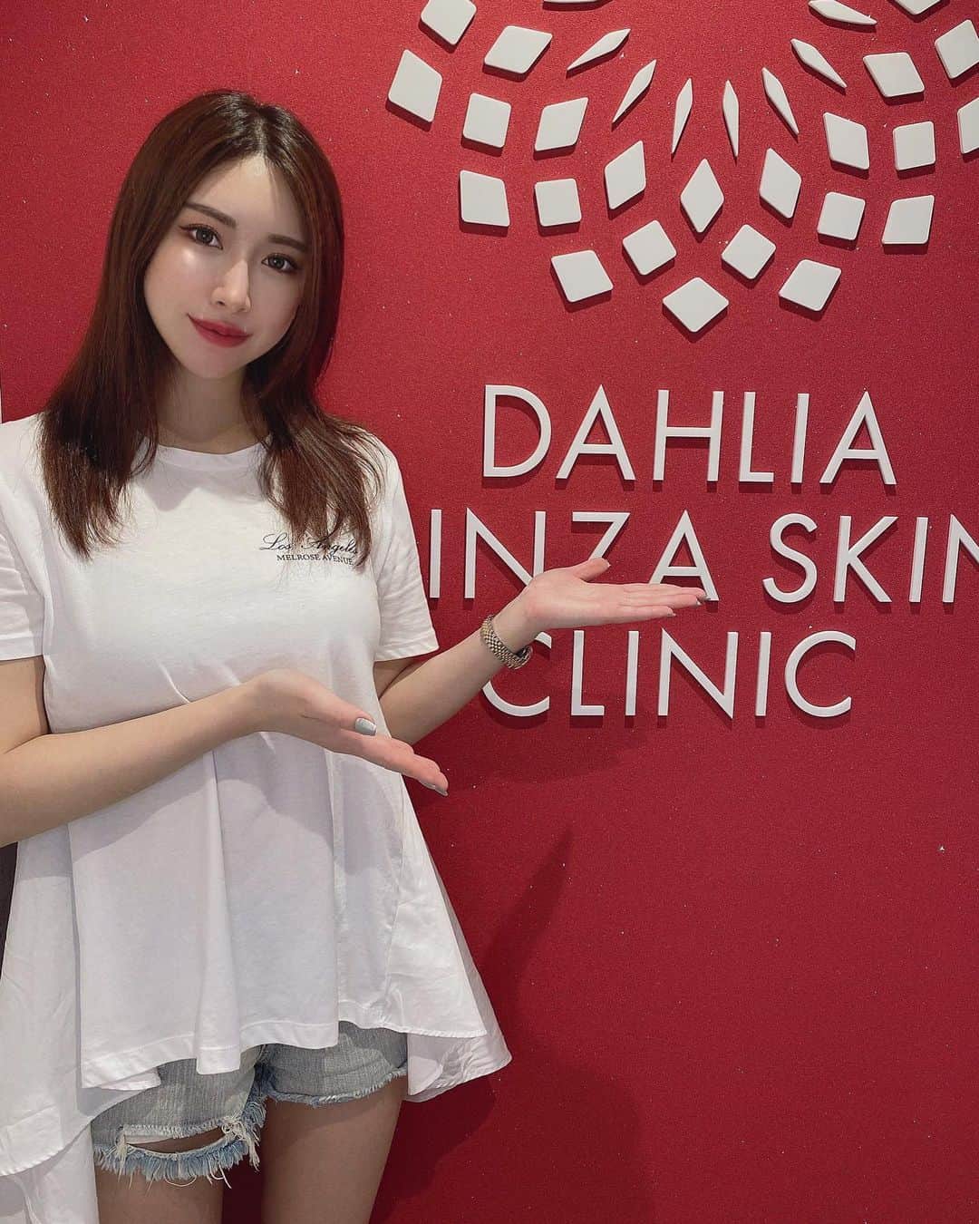 のインスタグラム：「先日、 ダリア銀座スキンクリニック (@dahliagsc )で 『肩ボトックス』を打ってきたよ🍒 _ 『肩ボトックス』は 肩の凝りや張りが気になる方、 日常的に長時間のデスクワークをされている方、 長年スポーツをしていて筋肉が発達している方 におすすめの治療✨ _ ボトックスを打つことで筋肉が縮小し、 肩の凝りや張りが軽減されて 肩のラインがなだらかになることによって 首が長く見えたり、全体のバランスが良くなるため 小顔効果も期待できる💎 _ 効果は1週間〜1ヶ月を目安に 徐々にでてくるよ◎ _ とても細い針なので麻酔は使わず、 少し冷やしてから 肩周りに左右3箇所づつ打ったけど 痛みもチクッとするくらいで殆どないよ✨ 痛みに弱い方でも安心して受けられると思う☺️ _ 施術を担当してくださったのは 美容皮膚科医 あいら先生(@dr_aira_skinskin )です🙎‍♀️ _ __ _ __ #ダリア銀座スキンクリニック #ダリア銀座 #ダリア美肌 #スキンケア #美容皮膚科 #ボトックス注射 #ボトックス #肩ボトックス #デコルテ #肩凝り #肩こり解消 #デスクワーク #筋肉痛 #脇ボトックス #アラガン #ボトックスビスタ #小顔 #美容 #美容好き #美意識 #美意識向上 #女子力アップ #プチ整形 #美容医療 #モニター募集」