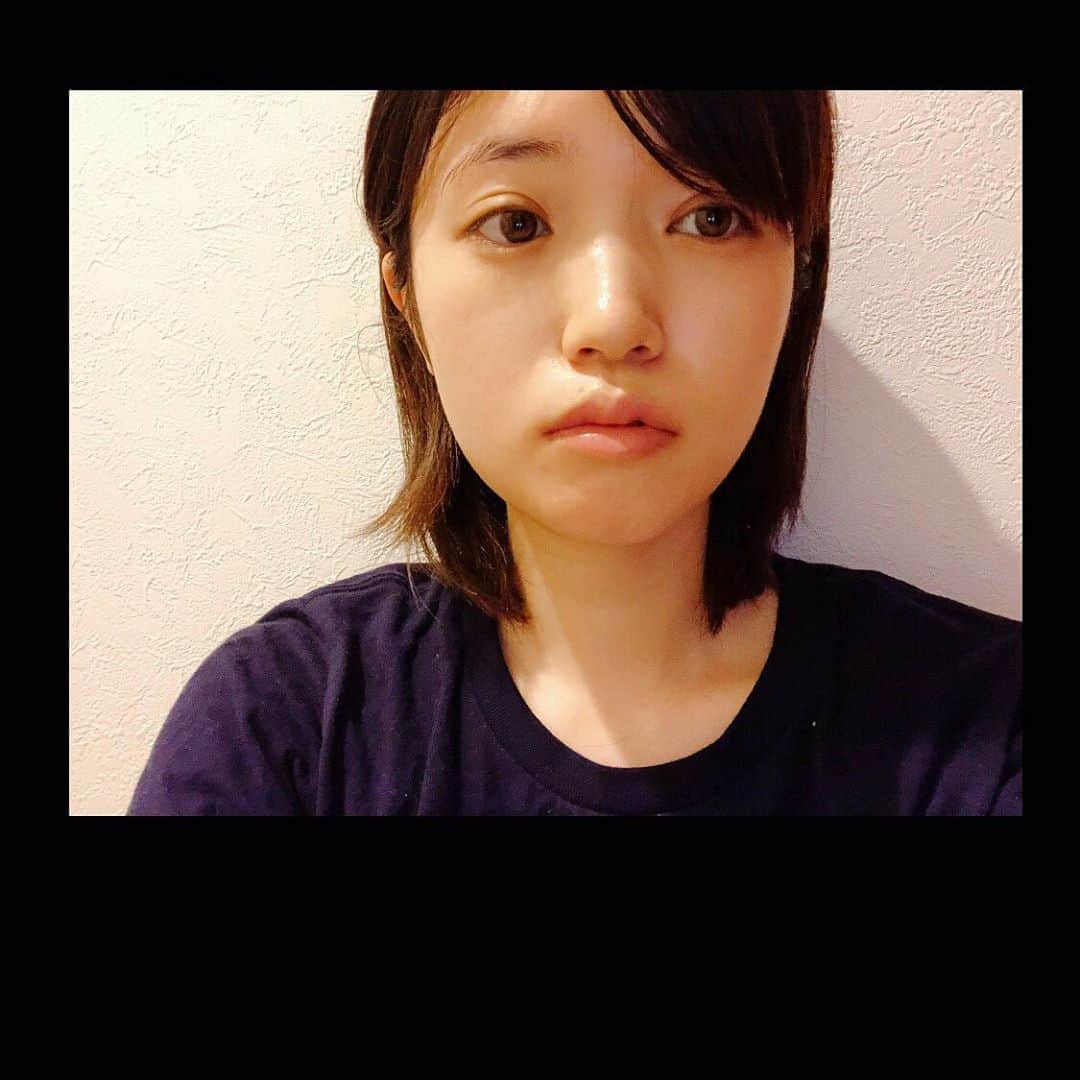 美山加恋のインスタグラム：「なんの写真？  ってなるかな。  実は前に親知らずを抜いたときのやつ。  写真でみるとそんなにだね…？  この時点で抜歯2日目。  ここらから腫れるの⁉︎それとも無事治るの⁉︎  とドキドキしていた。  思ったより腫れなかったけど、痛かったなぁ…。  親知らず、恐るべし。  ちなみにしばらく載せたら消すかもしれない。ぼっさぼさだし。。」