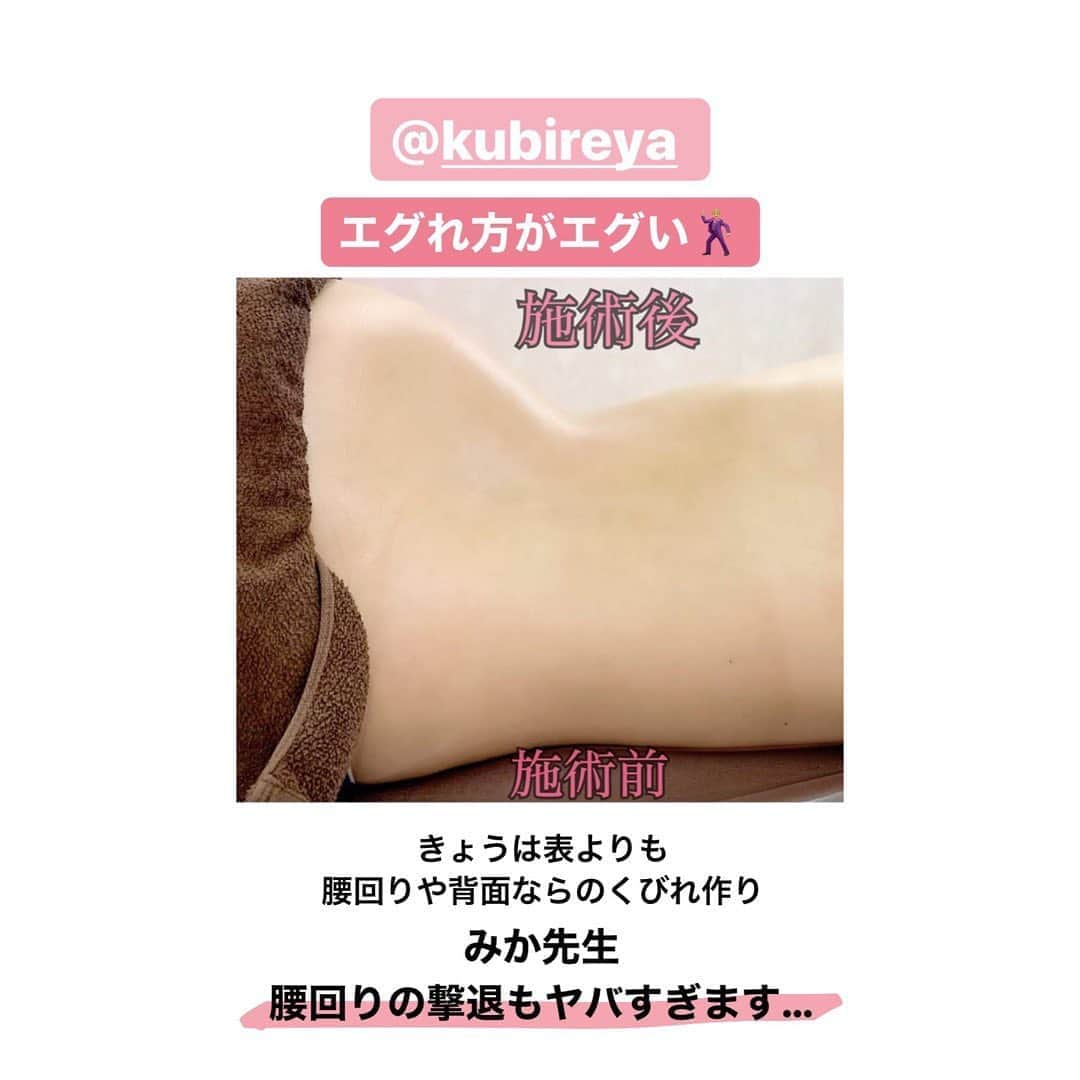 神子島みかさんのインスタグラム写真 - (神子島みかInstagram)「. 究極の痩身はここ @kubireya さんでございます🔥 (4〜7枚目のBeforeAfter参考に) . . 骨格ストレート ガリガリにならないと削げない二の腕… 今回は二の腕痩身ケアを重点的にやって来ました💪🏻💪🏻💪🏻 . . ちなみに！！！ 私とくびれyaのフォロワー様割引で 3種類の二の腕ケアがお得に受けられますので 最後までご一読下さい🕺🏼💕 . . . 【二の腕①】90分 ⑴パーフェクトシェイプ ⑵マジックポーラ ⑶グロッティ脂肪溶解導入 . ¥110,000↓ 🉐¥36,800+tax --------------------------- 【二の腕-③】60分 ⑴ HIFU 1000ショット ⑵マジックポーラ . ¥82,500↓ 🉐¥25,000+tax --------------------------- 【二の腕-⑥】60分 ⑴フォースカッター . ¥27,500↓ 🉐¥15,000+tax . . 今回はさらに【ペア割】があります👯‍♀️ 🉐2人ペア予約で1人¥5,000の割引🉐 . 可愛いペアルームでエステデートや お友達やご家族彼氏と是非行ってみて下さい🧖🏻‍♀️✨ . . #くびれya さん お引越しされまして以前の店舗から 徒歩30秒程(9枚目の動画)で内装がほんと PowerUPして素敵空間でした😳🔥 . . #マジックポーラ #HIFU#hifu#ハイフ #二の腕痩せ#アラサー #ママ#美活#美容 #綺麗になりたい#34歳 . . ⋆⸜ᵀᴴᴬᴺᴷ ᵞᴼᵁ⸝⋆」7月11日 18時41分 - kagomika