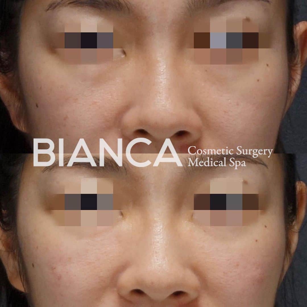 辻沢由有（BIANCA CLNIC 表参道院 院長）のグルメインスタ