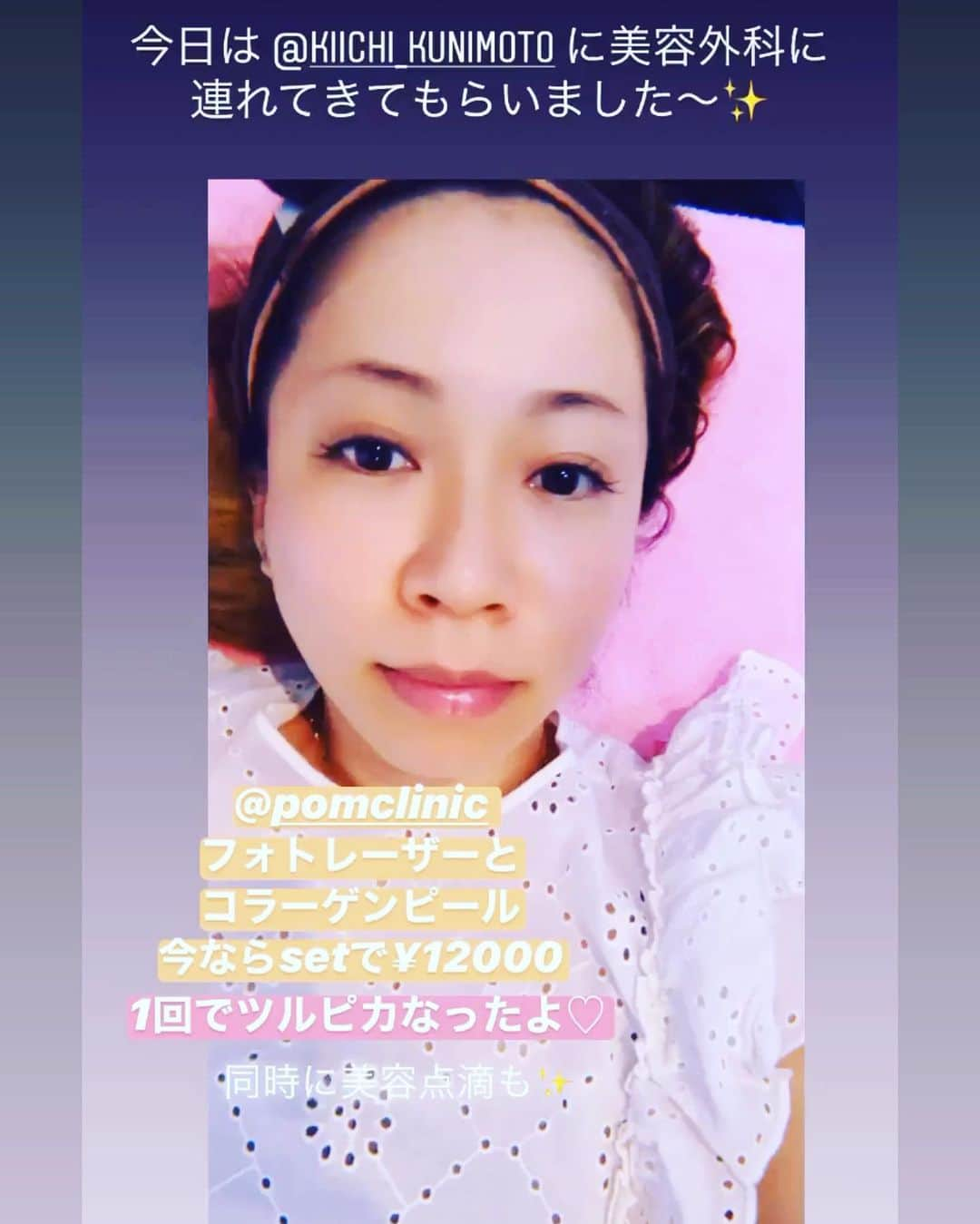 ストラッサー起一さんのインスタグラム写真 - (ストラッサー起一Instagram)「先日、子育て頑張ってる麻美を美容クリニックに連れて行って来ました👍 場所は心斎橋にある【ポムクリニック】さん。 この日は麻美はフォトレーザーとコラーゲンピールと美容点滴。 施術後に嫁の肌はツルツルに輝いてて美容って凄いと思いました！！！ 僕は高濃度ビタミンとニンニクの点滴して疲労回復💪 今回、麻美も喜んでくれて良かったです。 スタッフの皆さんも親切にして頂きありがとうございました。 また次回も宜しくお願い致します🥺  ★ポムクリニック https://www.pom-clinic.com  #ポムクリニック  #美容 #心斎橋 #大阪」7月14日 0時56分 - kiichi_kunimoto