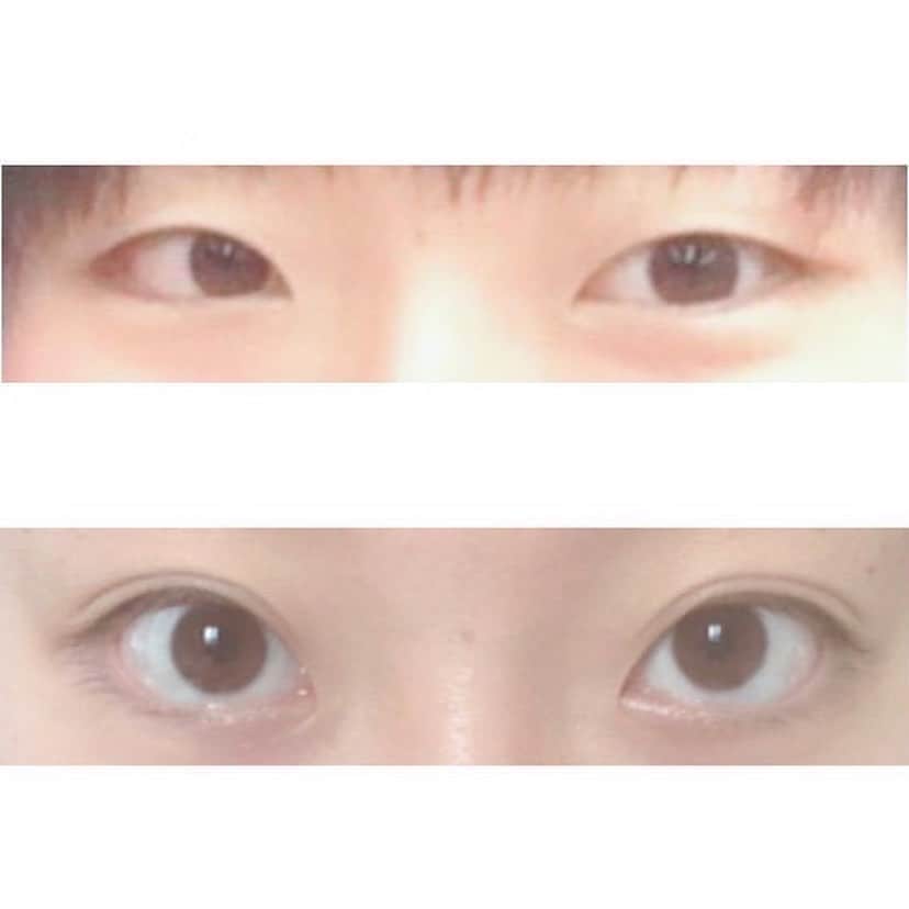 美容整体師川島さん。のインスタグラム：「【二重マッサージ結果報告】 今回も、二重ビフォアフターが届きました。 . 昔から重い一重だったのが マッサージのみで二重に👀 . 嬉しかったし、二重になりたい子たちにも 勇気与えられると思ってシェア☺️ . #整体Filament」