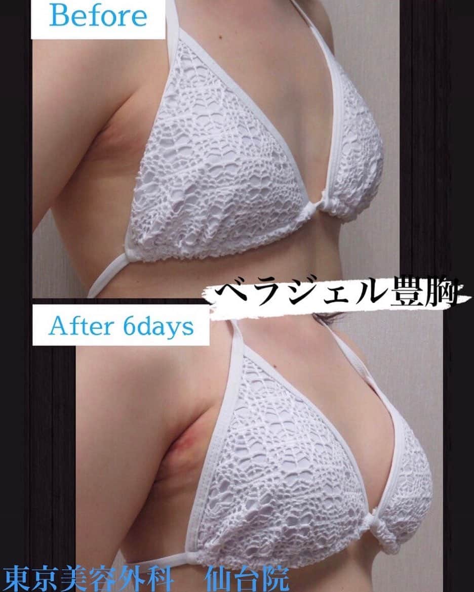 東京美容外科公式のインスタグラム