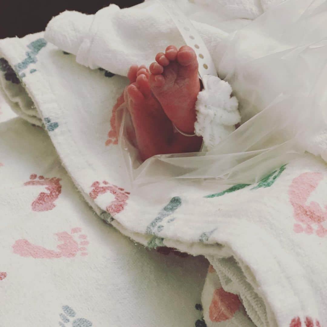 Camille Leblanc-Bazinetさんのインスタグラム写真 - (Camille Leblanc-BazinetInstagram)「Zoe Lipson  07/13/20 2lbs 14oz 9:52pm  We got a big surprise yesterday. Please pray for our baby girl who is working really hard to stay with us.   Monday, I notice that a hadn’t felt our baby move, she is normally very active. We tried to stimulate her and when it didn’t worked we were send to the hospital. Her vital signs were not great and the doctors decided she would be safer out. We ended up having an emergency C-section at night to save the baby.  We heard her cry, she is working hard, breathing on her own with a C-PAP mask. 30 weeks and 2 days old, 2lbs and 14 oz she is active and fussy and battling. We are here living with her in the NIC-U. Those are all the details, we will keep you updated. Please allow for our privacy as we work through this.」7月15日 9時17分 - camillelbaz