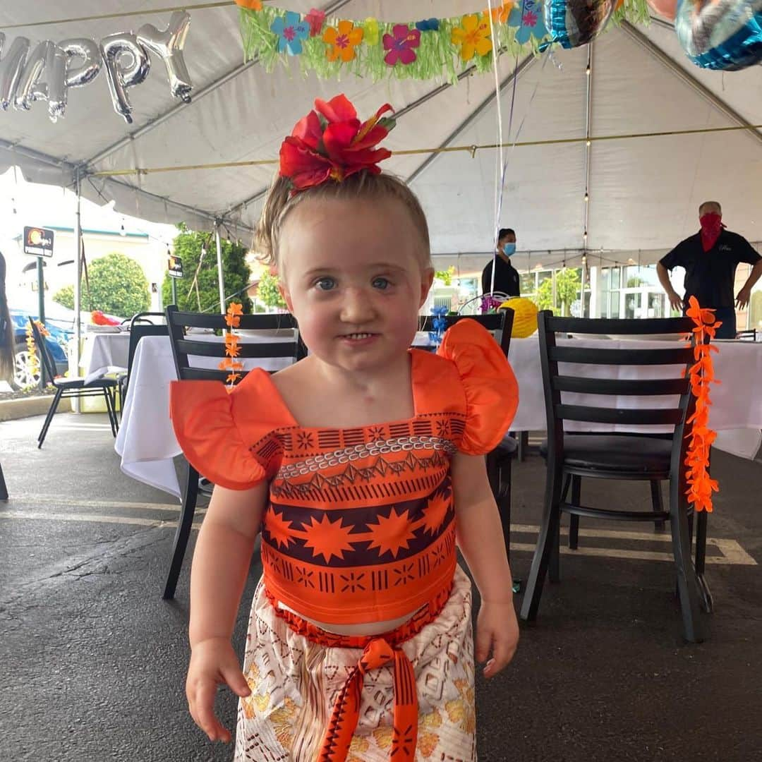 People Magazineさんのインスタグラム写真 - (People MagazineInstagram)「Long Island toddler Alessia Sansotta-Ingrasselino was on the cusp of death after being attacked by a pit bull, but a surgeon gave her a second chance at life. And as she celebrated her second birthday, she was joined by Dr. Rachel Ruotolo, the pediatric plastic and craniofacial surgeon who performed the toddler's facial reconstruction surgery and saved her life. ❤️ "[Dr. Ruotolo is] forever in our life. Anybody that looks at Alessia for the rest of her life is looking at what she's done, so forever I am grateful to her," said Alessia's mother, Dianna Sansotta-Ingrasselino. Tap the bio link for Alessia's story. 📷: Long Island Plastic Surgical Group, PC」7月16日 11時34分 - people