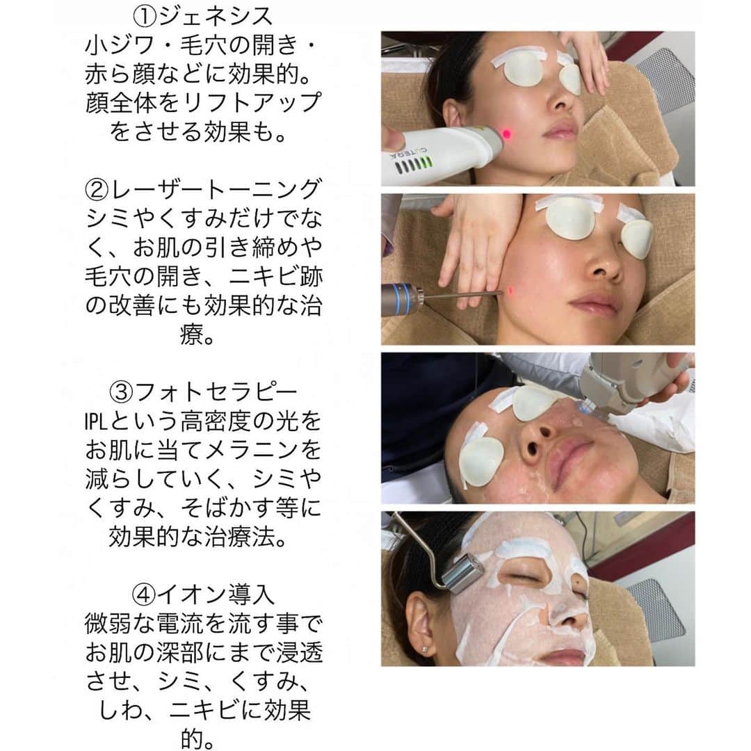 IIDA YURIさんのインスタグラム写真 - (IIDA YURIInstagram)「久しぶりにレーザーなどをしに  @taro_biyouへ ここはカスタマイズ治療ができる美容皮膚科  その方にあった機械を選んでもらって、すっぴん肌で外出できるぐらいの肌を目指す治療コース。  #まさに求めてた 診察で私の肌状態をみて施術↓  ①ジェネシス 小ジワ・毛穴の開き・赤ら顔などに効果的。顔全体をリフトアップをさせる効果も。  ②レーザートーニング シミやくすみだけでなく、お肌の引き締めや毛穴の開き、ニキビ跡の改善にも効果的な治療。  ③フォトセラピー IPLという高密度の光をお肌に当てメラニンを減らしていく、シミやくすみ、そばかす等に効果的な治療法。  ④イオン導入 微弱な電流を流す事でお肌の深部にまで浸透させ、シミ、くすみ、しわ、ニキビに効果的。 . 1回ではそんな効果ないかなーって思ったけど、終わったらワントーン明るくなってるし毛穴もキュッとなってやっぱりレーザーなどの機械はいいなーと🥺♥️ . 月1で頑張って通いたいなー✍🏼 . #カスタマイズ治療 #たろうメディカルクリニック #美容 #美肌 #美肌治療 #アンチエイジング #シミ治療 #タルミ治療 #美肌レーザー #美容クリニック #西宮」7月17日 22時36分 - yurima_ma