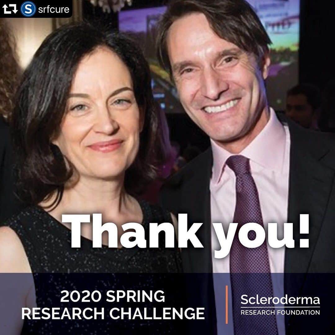 ボブ・サゲットさんのインスタグラム写真 - (ボブ・サゲットInstagram)「Throughout this incredibly difficult time, still working to help those afflicted with scleroderma, the disease that took my sister’s life. Thank you to our beloved #SclerodermaResearchFoundation and our Chairman, Dr. Luke Evnin and his wife, Board member, Deann Wright as well as all of our board members and staff for helping us meet our Spring Challenge goal. Please see below and thank you.  repost @srfcure ・・・ We did it! Many thanks to all of the SRF’s amazing donors who have so generously helped us raise more than $97,000, which together with our $75,000 match, equals at total of $172,000 raised for the Juvenile Scleroderma Project! This important project helps us better understand scleroderma in this vulnerable population and will give us clues about scleroderma in all patients. We are thrilled to have Dr. Kathryn Torok and the scientists at the NHGRI as partners in this endeavor!    Again, thank you. Together, we will make a difference.  Deann and Luke . . #srfcure #sclerodermaresearch #ResearchistheKey #sclerodermaresearchfoundation #scleroderma」7月18日 8時50分 - bobsaget