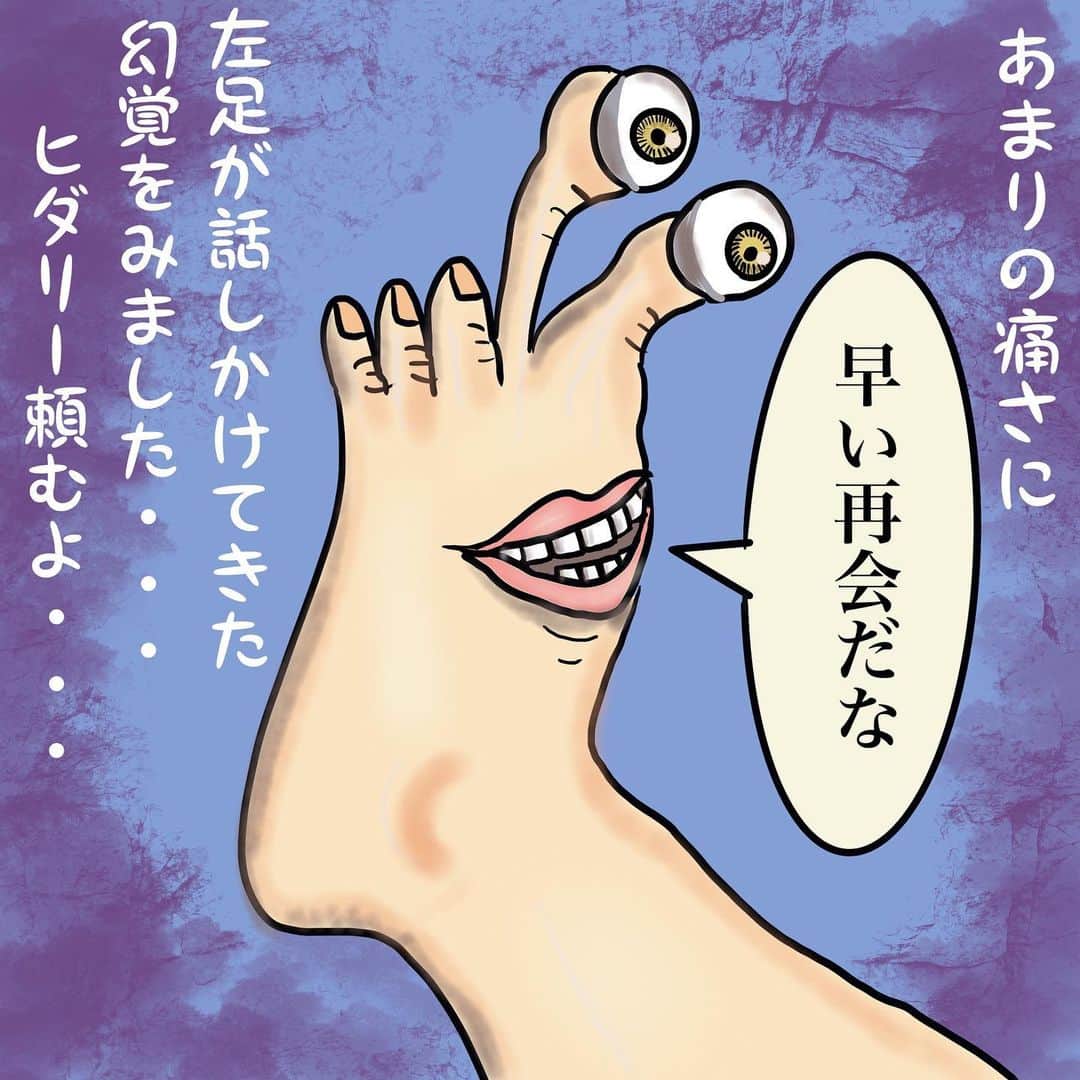 福島善成さんのインスタグラム写真 - (福島善成Instagram)「『続・痛風日記』 【激痛との再開】 こんなに早く痛風発作がでるなんて・・・いろいろ気を付けていたのに・・・ チクショー！ #続・痛風日記 #尿酸値高めの方へ」8月14日 17時13分 - fukushimayoshinari
