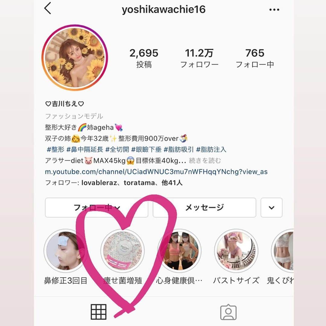 吉川ちえさんのインスタグラム写真 - (吉川ちえInstagram)「こんばんは🥺💕 . 最近腸活にハマってます🧸🎀 ダイエット停滞期の時になんで体重落ちないんだろ⁉️😱 って思って着目したのが"痩せ菌サプリ✨" . ダイエットしてると腸内環境が悪くなって便秘しやすかった😭‼️ だけど痩せ菌サプリで腸内環境整えたら 便秘も改善されたし体重もスルスル落ちたし腸内を整えるって大切なんだと実感した😂💗💗 . 感動しすぎた🥺🥺腸内環境大切✨ プロフィールページから痩せ菌サプリについて詳しくハイライト残してるので飛んで見てください🙌❣️ . #ダイエット #ダイエット停滞期 #便秘解消 #腸内環境 #痩せ菌 #痩せ菌増やす #ダイエット好きな人と繋がりたい」8月15日 19時06分 - yoshikawachie_16