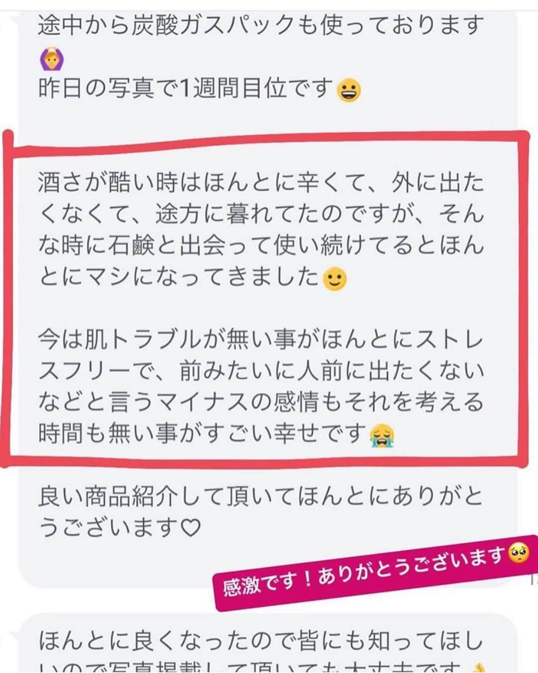 kogao283さんのインスタグラム写真 - (kogao283Instagram)「販売受付停止中！再販はInstagramにて告知致します！」8月16日 14時27分 - kogao283