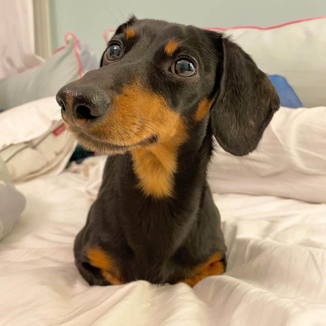 Crusoe the Celebrity Dachshundのインスタグラム：「“UPDATE: it’s been two weeks since my last blood test/update, and we just did another one today. Happy to say both enzymes have come down a lot! They were 5x normal two weeks ago and now only 3x normal! So the downward trend continues thankfully, and although not quite in the clear just yet, Mum and Dad are starting to be a bit more relieved finally! 😊 Thank you all for your continued concern and care for me. As always, much ❤️” ~ Crusoe」