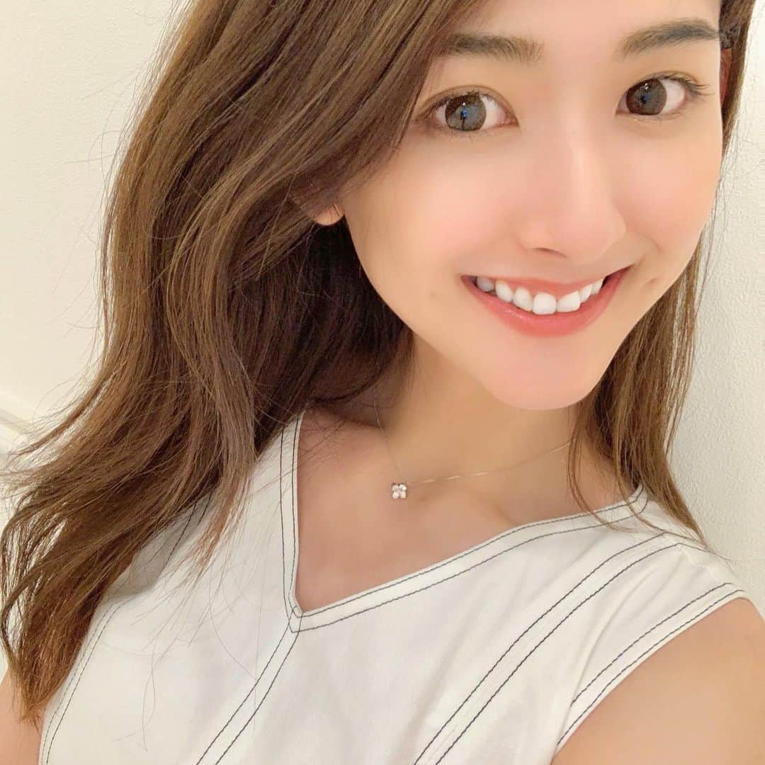 のインスタグラム：「@a_clinic_ginza さんで、 Aスレッドを受けてきました♡ 担当していただいたのは @dr_kanayamasaki 先生✨  カウンセリングしてもらい 左側の方が肉が付きやすいから そのバランスも見て施術してもらいました♪ あとはエラの筋肉が張りやすいからボトックスもしたほうがいいよ。って アドバイスも☺️！ 今度やってもらおう〜💓💓  術後は腫れもなくてそのままお出かけしました❣️ 次の日撮影だったんだけど お化粧も入浴も当日からOKだから助かりました泣🙌  痛いのが大嫌いな私も大丈夫だったので やりたいけど怖い。不安。って思ってる人 安心してください♡  小顔になりたい人はAスレッドおすすめです☺️ . . . #aスレッド #aclinic #aclinic銀座 #aクリニック #美容 #小顔 #美肌 #リフトアップ #美容外科 #美容皮膚科 #美容クリニック#山崎香名」
