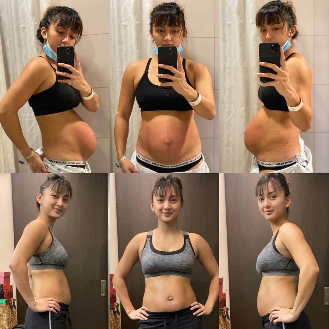 Iya Villaniaさんのインスタグラム写真 - (Iya VillaniaInstagram)「Top: Taken right after delivery (tummy is red coz it felt soooo good to scratch 😂🙈) Bottom: Taken a week after delivery with the daily use of a binder Diet: A good mix of nutritious and food that makes me happy 😆😂 Thanks to those sending over all sorts of things from baked goods to ulam 😂 Workout: Round the clock breastfeeding  Crazy what a mother’s body goes thru! Being so much kinder and patient with my body this time 😊My body isn’t where I want it to be but I’m okay with that. It will take time and I’m in no rush 😊 Work starts this week but waiting it out another week before I really get moving and ease back into my regular grind 😅 reminding myself that recovery is just as important and enjoying every minute of it 😊 but I can’t wait to sweat again! 😅 will fill you guys in with my journey including all the things that I feel have been helping me recover this time around 😊 #RecoveryAfter3」7月27日 6時39分 - iyavillania