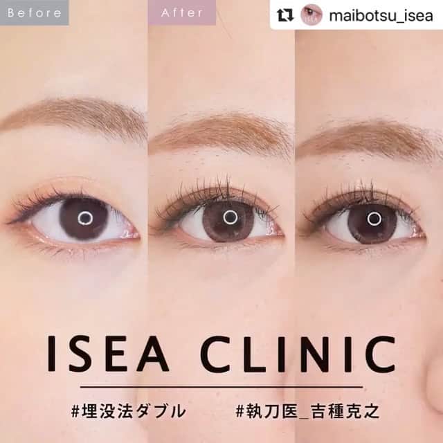 東京イセアクリニックのインスタグラム