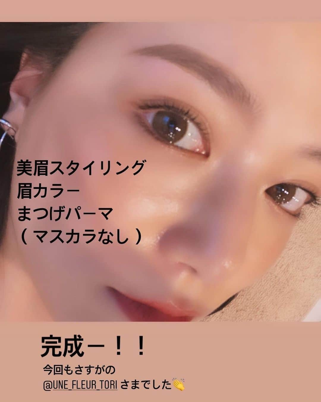 石井里奈さんのインスタグラム写真 - (石井里奈Instagram)「こんばんは✨ . 今夜は美容投稿まとめ💕 . 先日、 @rillee_on でHIFU（ハイフ）の進化系のSonicFitの2回目を受けてきました✨ . いつもbeforeafterを撮ってるのですが、驚いたのが1回目の施術後と2回目の施術前がそんなに変わってないこと✨それだけ継続力あるって感動💕 . HIFUよりも全然痛くないし低価格で効果もあるので本当におすすめ！！ 気になっていたほうれい線も薄くなってフェイスラインがすっきりして嬉しかった〜🥺✨髪の毛まとめたくなる🙆‍♀️ . ヘアも @aidaman321 さんの新しいサロンでトリートメントしたおかげで艶さら髪に🙏表参道駅近すぎてこれから通いやすそうです💕（3.4枚目） . そして眉毛スタイリングとまつげパーマを @une_fleur_tori ちゃんに👏 @classy_mag_insta でも紹介していますがtoriちゃんにはもう3年くらい眉毛お世話になってます🙏💕 . この日のメイクは @nadea_makeup ちゃんにやってもらったよ❤️ @narsissist のグロス買わなくちゃ🛍笑 . 女の子は色々大変だけど、その分綺麗に変化できると楽しいよね❣️努力する分綺麗になれるっ🙆‍♀️💕 . コーデまた載せます👗 今日もお疲れ様でした❤️ . #リリーオン #ソニックフィット #小顔 #リフトアップ #sonicfit #フェイシャルエステ #小顔矯正 #フェイスライン #ほうれい線 #ヘアトリートメント #トリートメント #frayid #フレイアイディー #眉毛 #眉毛メイク #まつげパーマ #classy_leaders #白ワンピ #ヘアアレンジ #narscosmetics #ナーズ #おすすめらコスメ #ヘアスタイル #小顔カット #小顔ヘア #ポニーテール #エステ #渋谷エステ #渋谷 #shibuya」7月30日 20時18分 - ri7tin1025