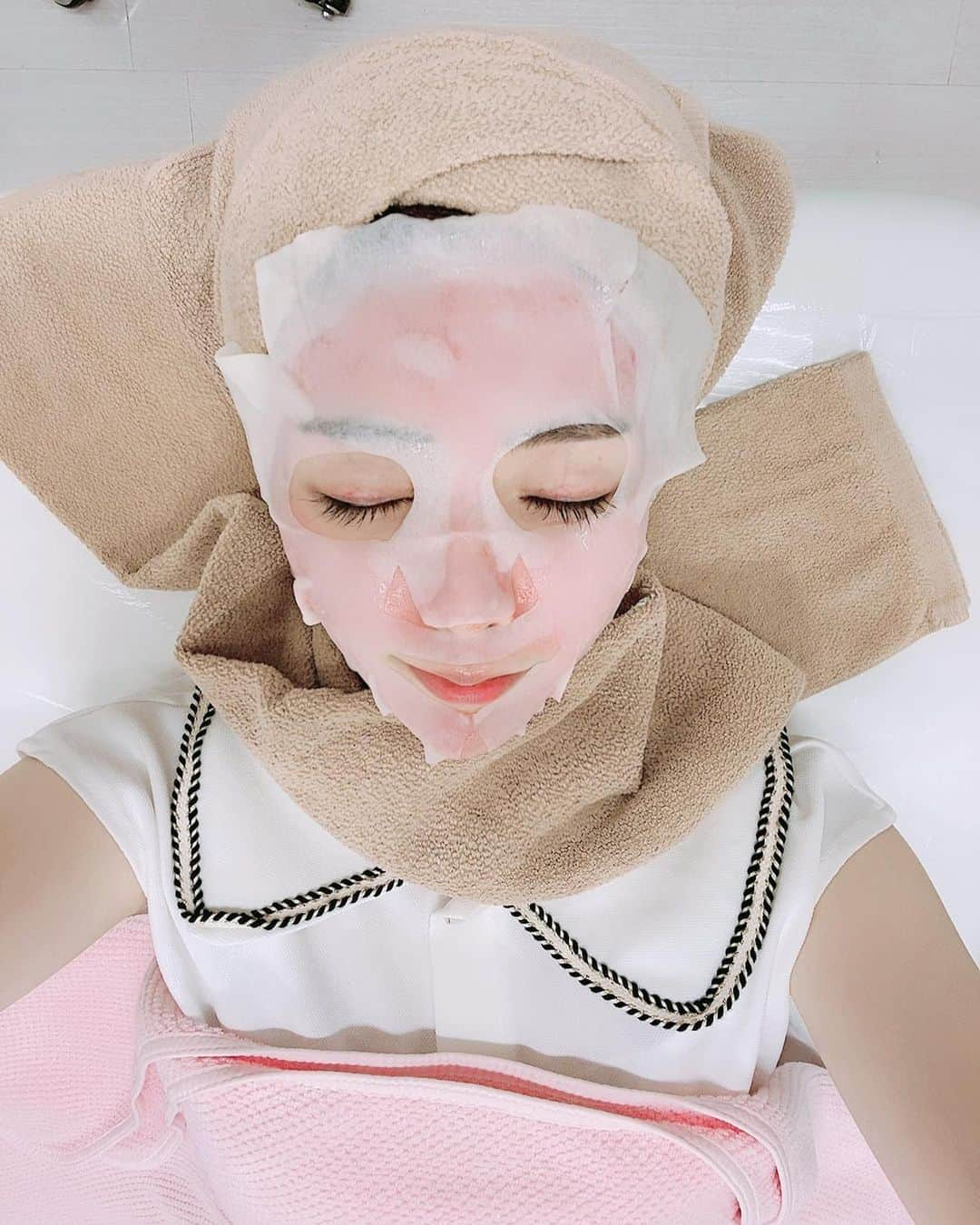 優月美羽さんのインスタグラム写真 - (優月美羽Instagram)「@venus_beauty_clinic に🚶‍♀💓💭 ダーマペン4 受けに久しぶりに💕 ダーマペン4 はもう3回目だよ🙊‼️ハマってる🤣めちゃいい🧏‍♀️🧡💜🧡  ダウンタイムは2、3日👀✌ 2、3日は赤み出てるけど 赤みもちゃんと引くよ♡ 洗顔は24時間後からOK🧖‍♀️🧡  数日後にはハリのあるお肌になるし毛穴も小さくなるし、頑固なニキビ跡にも🙆‍♀️✨ シワやタルミへの効果も期待できるみたいなのでアンチエイジングにも😊👍 術後のパックもすごく気持ちいよ😉🌿  #venusbeautyclinic #ヴィーナスビューティークリニック #新宿店 #新宿御苑 #ダーマペン4 #ダーマペン #アンチエイジング #美容クリニック #美容好きな人と繋がりたい #スキンケア #シワ改善 #美肌ケア #お肌ケア #ボトックス #ボトックス効果」7月30日 15時08分 - miu.yuzuki