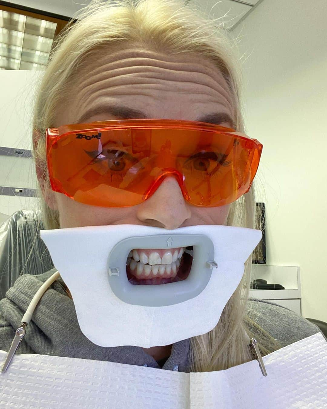 リンゼイ・ボンさんのインスタグラム写真 - (リンゼイ・ボンInstagram)「The dentist is so lit 🔥」7月31日 3時51分 - lindseyvonn